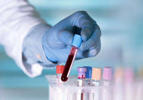 shutterstock_441264445 (1) HIV Testing Beaumont, TX